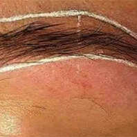 MICROBLADING